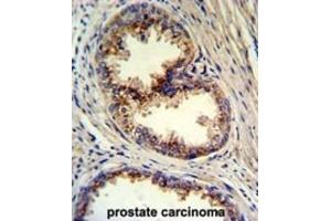 Immunohistochemistry (IHC) image for anti-Golgi phosphoprotein 3 (Coat-Protein) (GOLPH3) antibody (ABIN3003211) (GOLPH3 antibody)