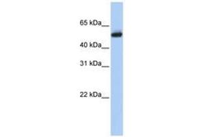Image no. 1 for anti-Cytochrome P450, Family 4, Subfamily B, Polypeptide 1 (CYP4B1) (AA 72-121) antibody (ABIN6740739) (CYP4B1 antibody  (AA 72-121))