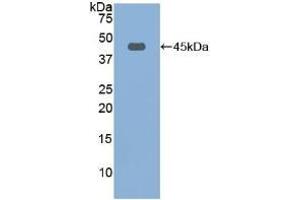 Detection of Recombinant FBLN1, Rat using Polyclonal Antibody to Fibulin 1 (FBLN1) (Fibulin 1 antibody  (AA 127-243))