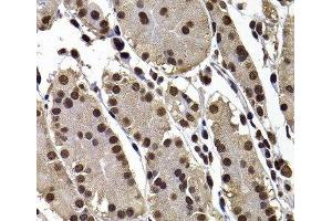 Immunohistochemistry of paraffin-embedded Human stomach using GPS1 Polyclonal Antibody at dilution of 1:100 (40x lens).