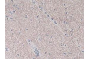 IHC-P analysis of Human Brain Tissue, with DAB staining. (IL-8 antibody  (AA 23-101))