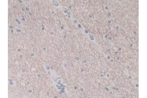 IHC-P analysis of Human Brain Tissue, with DAB staining. (IL-8 antibody  (AA 23-101))