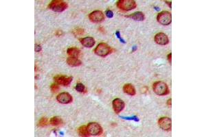 Immunohistochemical analysis of INPP5J staining in human brain formalin fixed paraffin embedded tissue section. (INPP5J antibody  (C-Term))