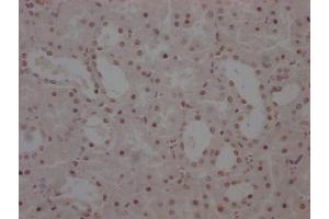 IHC image of ABIN7127870 diluted at 1:100 and staining in paraffin-embedded human kidney tissue performed on a Leica BondTM system. (Recombinant WT1 antibody)
