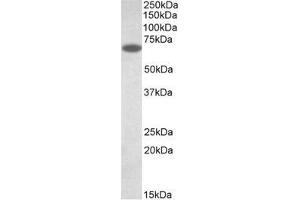 AP32138PU-N PDIA2 antibody staining of Human Pancreas lysate (35µg protein in RIPA buffer).