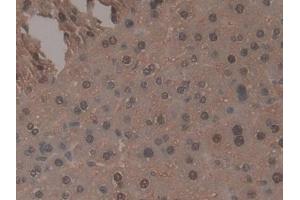 DAB staining on IHC-P; Samples: Mouse Liver Tissue (TNP1 antibody  (AA 3-53))