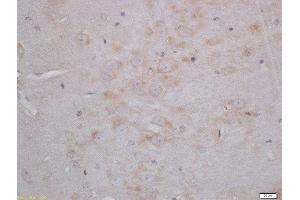 Formalin-fixed and paraffin embedded rat brain tissue labeled with Anti-Neurogranin Polyclonal Antibody, Unconjugated(ABIN1387517) 1:200, followed by conjugation to the secondary antibody and DAB. (Neurogranin antibody  (AA 30-78))