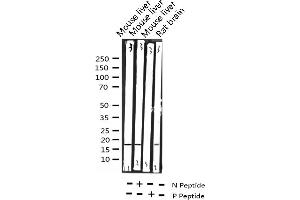 Western blot analysis of Phospho-4E-BP1 (Thr36) expression in various lysates (eIF4EBP1 antibody  (pThr36))