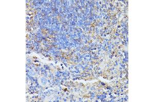 Immunohistochemistry of paraffin-embedded mouse spleen using STK24 antibody (ABIN6132364, ABIN6148602, ABIN6148603 and ABIN6214875) at dilution of 1:100 (40x lens). (STK24 antibody  (AA 312-431))