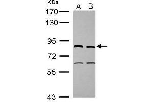 WB Image Sample (30 ug of whole cell lysate) A: IMR32 B: U87-MG 7. (ERCC2 antibody  (Internal Region))