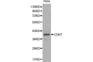 Western Blotting (WB) image for anti-Cyclin-Dependent Kinase 7 (CDK7) (AA 1-346) antibody (ABIN6218792) (CDK7 antibody  (AA 1-346))
