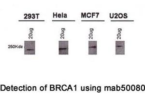 Image no. 2 for anti-Breast Cancer 1 (BRCA1) (AA 1314-1600), (AA 1314-1864) antibody (ABIN363234) (BRCA1 antibody  (AA 1314-1600, AA 1314-1864))