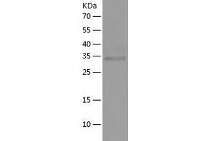 DPPA4 Protein (AA 1-304) (His tag)