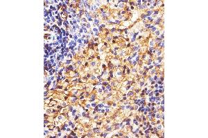 Immunohistochemistry (Paraffin-embedded Sections) (IHC (p)) image for anti-Major Histocompatibility Complex, Class I, B (HLA-B) (AA 75-107), (N-Term) antibody (ABIN1944779)