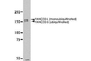 Western blot analysis of FANCD2 in HeLa whole cell extract using FANCD2 polyclonal antibody .