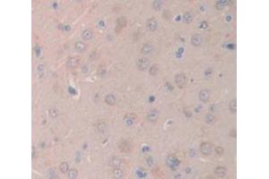 IHC-P analysis of Rat Tissue, with DAB staining. (IL1R1 antibody  (AA 226-352))