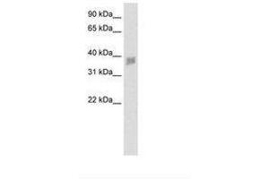 SNAPC3 antibody  (N-Term)