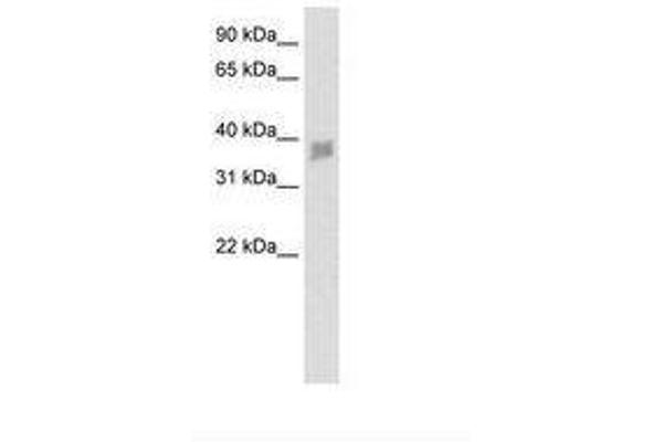 SNAPC3 antibody  (N-Term)