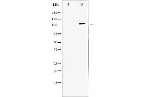 Western Blotting (WB) image for anti-Dynein, Axonemal, Heavy Chain 8 (DNAH8) antibody (ABIN1845418) (ATPase antibody)