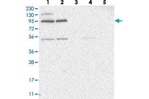 Western blot analysis of Lane 1: RT-4, Lane 2: U-251 MG, Lane 3: Human Plasma, Lane 4: Liver, Lane 5: Tonsil with ZNF341 polyclonal antibody  at 1:250-1:500 dilution.