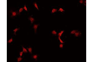Immunofluorescence (fixed cells) (IF/ICC) image for anti-Jun Proto-Oncogene (JUN) (N-Term) antibody (ABIN6260336)