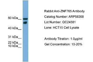 WB Suggested Anti-ZNF765  Antibody Titration: 0. (ZNF765 antibody  (N-Term))
