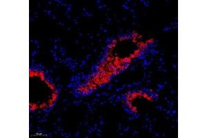 Immunofluorescence of paraffin embedded rat lung+LPS using ATP6V1C2 (ABIN7073157) at dilution of 1:200 (200x lens) (ATP6V1C2 antibody)