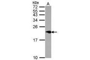 Image no. 1 for anti-Niemann-Pick Disease, Type C2 (NPC2) (AA 1-151) antibody (ABIN1499802) (NPC2 antibody  (AA 1-151))