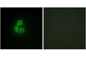 Immunofluorescence analysis of A549 cells, using CSK Antibody.