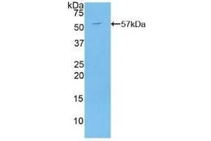Detection of Recombinant C2CD3, Human using Polyclonal Antibody to C2 Calcium Dependent Domain Containing Protein 3 (C2CD3) (C2CD3 antibody  (AA 1432-1647))