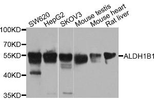 Western blot analysis of extracts of various cell lines, using ALDH1B1 antibody (ABIN5971915) at 1/1000 dilution. (ALDH1B1 antibody)