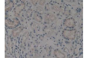 IHC-P analysis of Human Kidney Tissue, with DAB staining. (KRT15 antibody  (AA 274-399))