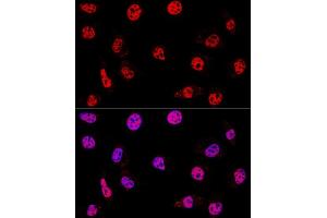 Confocal immunofluorescence analysis of L929 cells using HD Polyclonal Antibody (ABIN3020753, ABIN3020754, ABIN3020755 and ABIN6213707) at dilution of 1:200. (HDAC1 antibody  (AA 393-482))