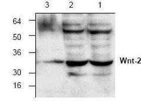 Image no. 1 for anti-Wingless-Type MMTV Integration Site Family Member 2 (WNT2) antibody (ABIN127198) (WNT2 antibody)