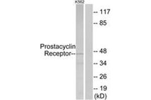Western blot analysis of extracts from K562 cells, using Prostacyclin Receptor Antibody. (Prostacyclin Receptor antibody  (AA 198-247))