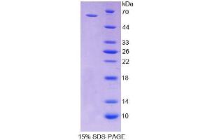 SDS-PAGE (SDS) image for CD19 Molecule (CD19) (AA 19-287) protein (His tag,GST tag) (ABIN6236798) (CD19 Protein (AA 19-287) (His tag,GST tag))