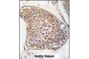 Formalin-fixed and paraffin-embedded human testis tissue reacted with TEK Antibody (C-term) (ABIN392059 and ABIN2841824) , which was peroxidase-conjugated to the secondary antibody, followed by DAB staining. (TEK antibody  (C-Term))