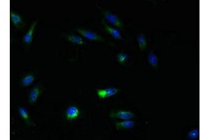 Immunofluorescent analysis of Hela cells using ABIN7144817 at dilution of 1:100 and Alexa Fluor 488-congugated AffiniPure Goat Anti-Rabbit IgG(H+L) (ATL3 antibody  (AA 1-187))