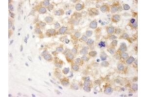 Immunohistochemistry (IHC) image for anti-DEAD (Asp-Glu-Ala-Asp) Box Polypeptide 3, X-Linked (DDX3X) (AA 1-50) antibody (ABIN7448520)