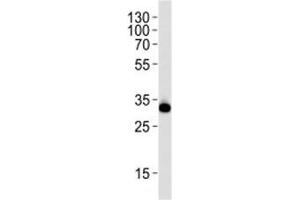 Western blot analysis of lysate from HeLa cell line using RPS6 antibody at 1:1000.