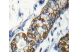 #VALUE! (SLAMF1 antibody  (AA 19-236))