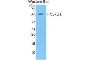Western blot analysis of the recombinant protein. (PDGF-BB Homodimer (AA 21-241) antibody)