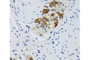 Immunohistochemistry of paraffin-embedded Human colon using HYOU1 Polyclonal Antibody at dilution of 1:100 (40x lens).