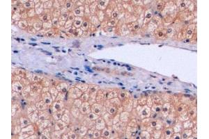 Detection of TYMS in Human Liver Tissue using Polyclonal Antibody to Thymidylate Synthetase (TYMS)