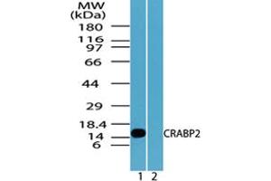Image no. 2 for anti-Cellular Retinoic Acid Binding Protein 2 (CRABP2) (AA 75-125) antibody (ABIN960117) (CRABP2 antibody  (AA 75-125))