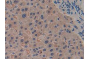 DAB staining on IHC-P; Samples: Human Liver Tissue (RPN1 antibody  (AA 180-307))