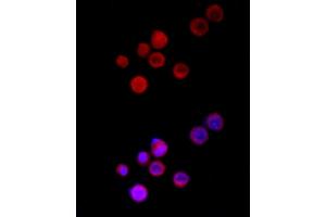 Immunofluorescence analysis of Neuro-2a cells using TRPC5 Rabbit pAb (ABIN6128835, ABIN6149578, ABIN6149579 and ABIN6214219) at dilution of 1:150 (40x lens). (TRPC5 antibody  (AA 764-973))