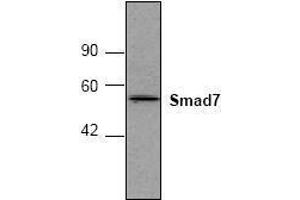 Image no. 1 for anti-SMAD, Mothers Against DPP Homolog 7 (SMAD7) antibody (ABIN127302) (SMAD7 antibody)