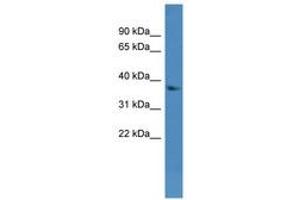 Image no. 1 for anti-Dehydrogenase/reductase (SDR Family) Member 7 (DHRS7) (AA 51-100) antibody (ABIN6746100) (DHRS7 antibody  (AA 51-100))