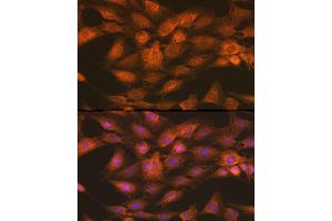 Immunofluorescence (IF) image for anti-Inhibitor of kappa Light Polypeptide Gene Enhancer in B-Cells, Kinase gamma (IKBKG) (AA 1-419) antibody (ABIN3021151)